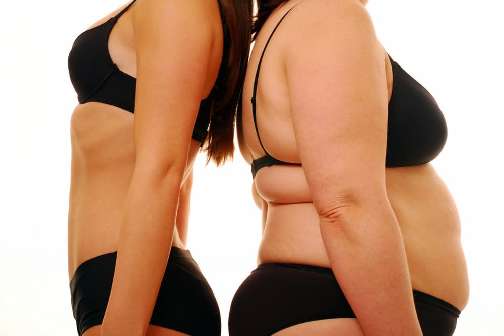 3. Колебания массы тела: ожирение и худоба