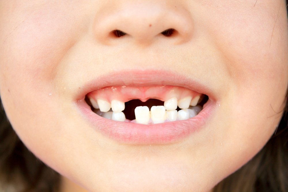 Когда выпадут молочные зубы у детей?
