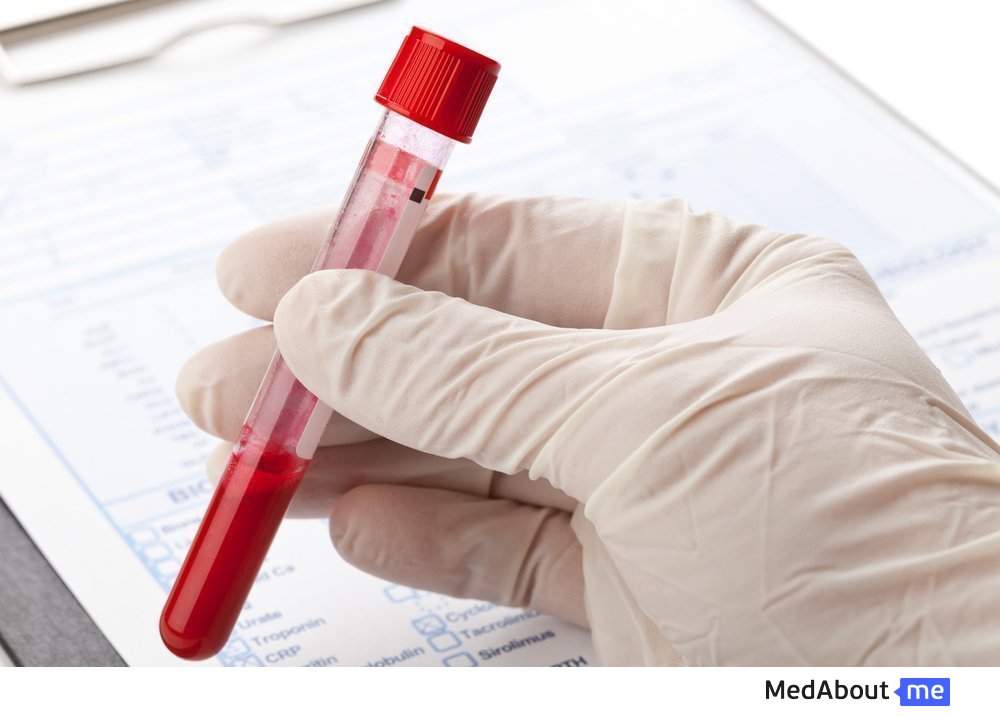Как анализ на антитела помогает определить причину болезни
