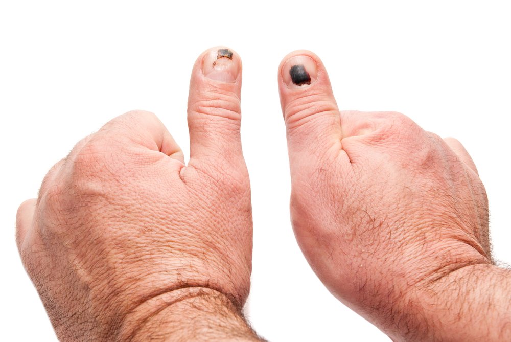 Болезни и изменения ногтевых пластин