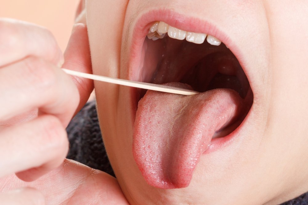 Терапия при герпетической инфекции во рту