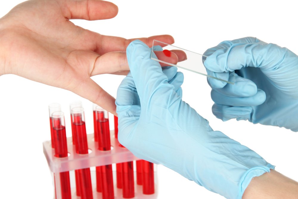 Лейкоциты в крови: о чем говорят отклонения