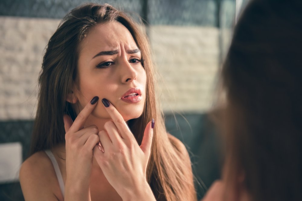 Каковы причины появления угрей на лице?