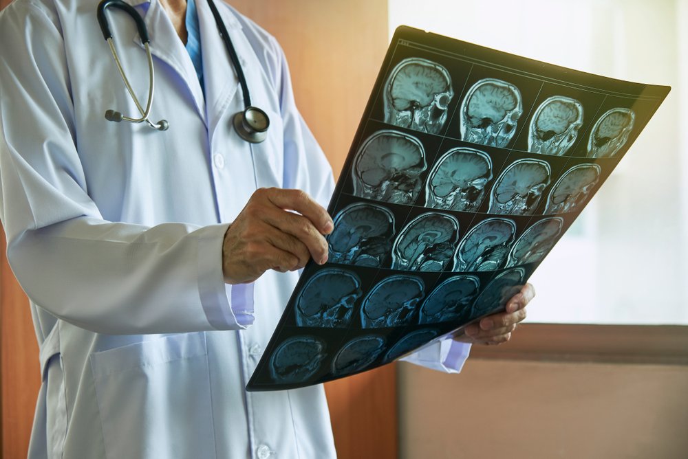 Как диагностируются сотрясения мозга?