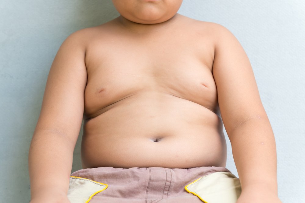 Распространенность детского ожирения