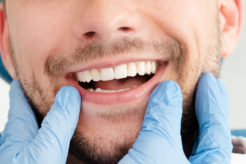 Молочные зубы у взрослых – аномалия?
