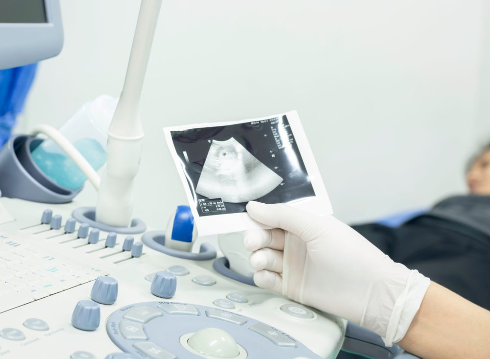 Предлежание плаценты во время беременности: что это?