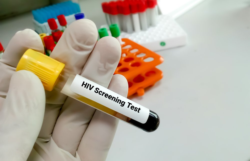 Методы диагностики ВИЧ-инфекции