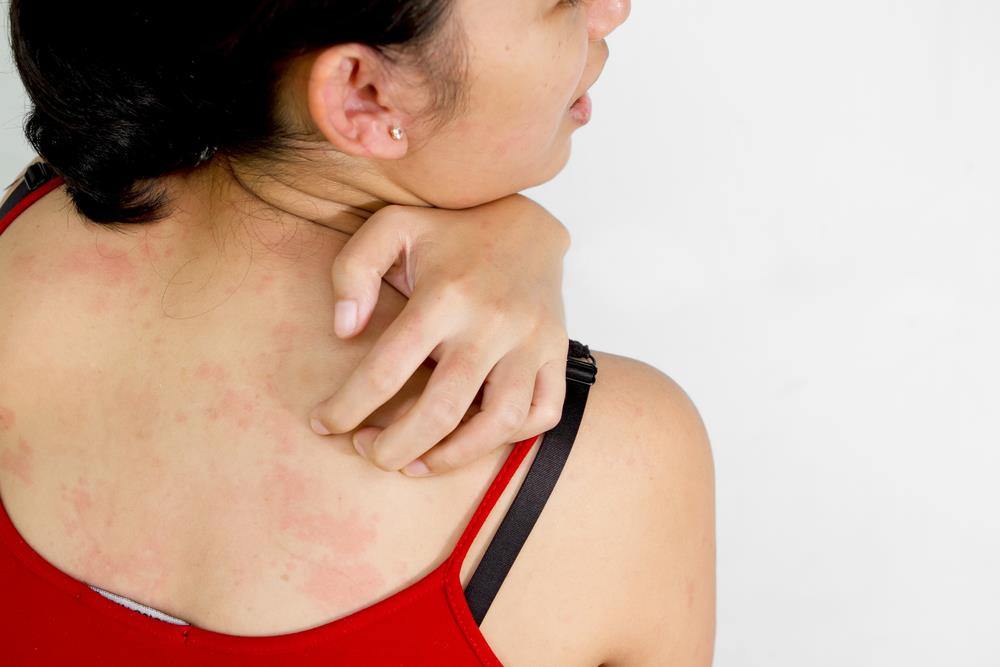 Каковы основные причины высыпаний на коже в районе спины и плеч?