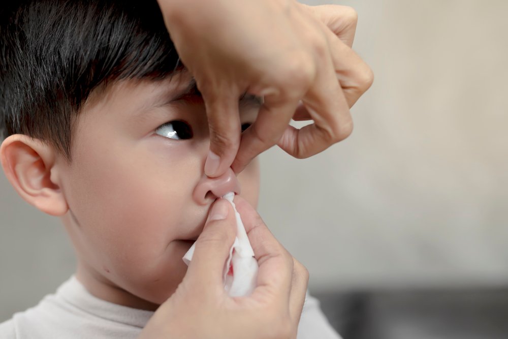Почему у детей может идти кровь из носа?