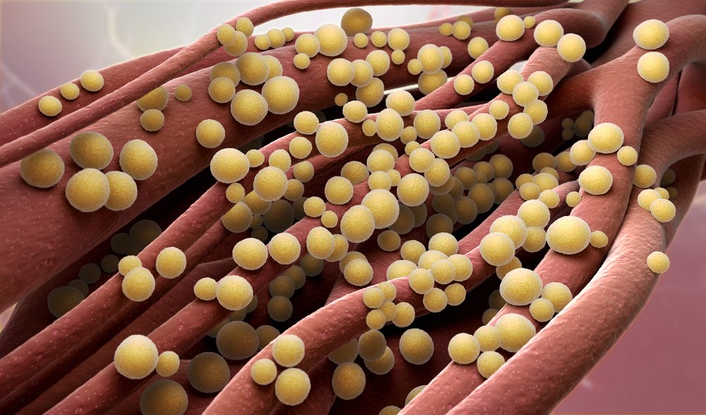 Какие болезни вызывает бактерия?