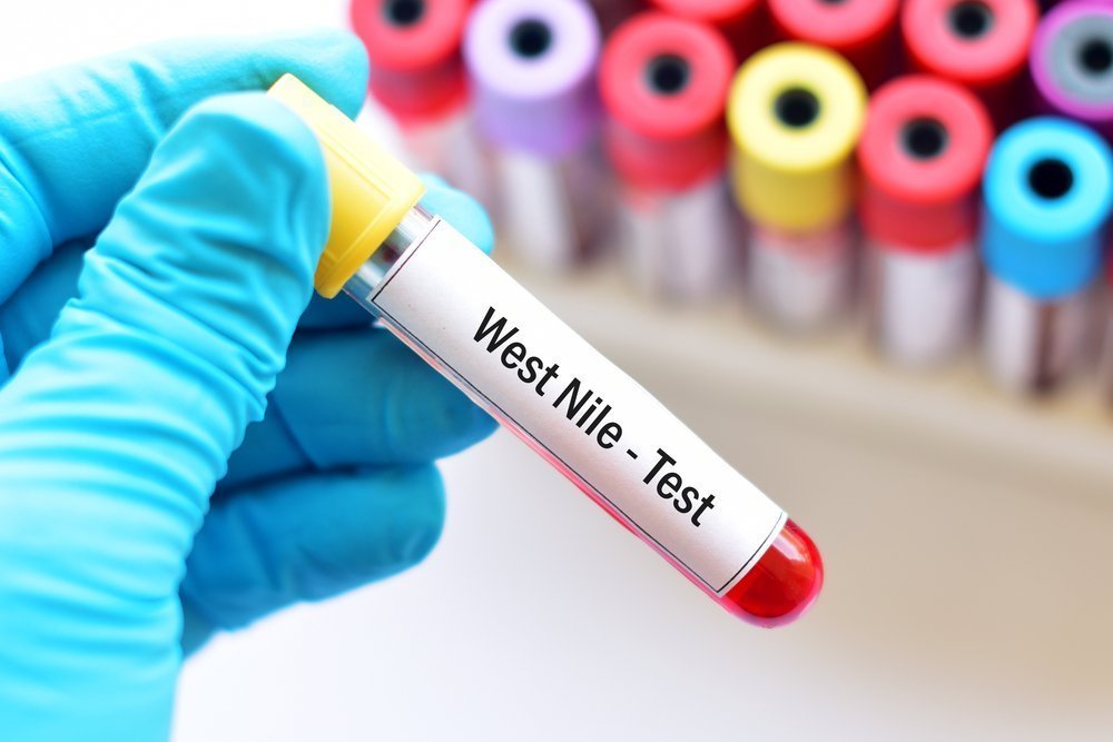 Вирус лихорадки Западного Нила: патогенез