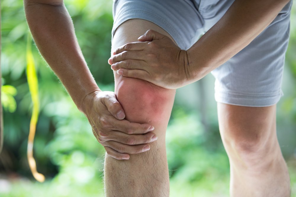 Причины развития артроза коленного сустава