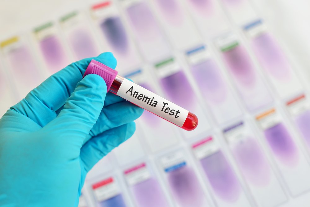 Что такое анемия?