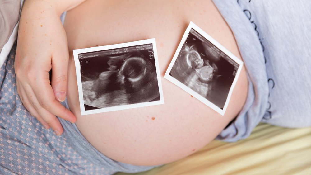 Одинаковые малыши: все решается в начале беременности