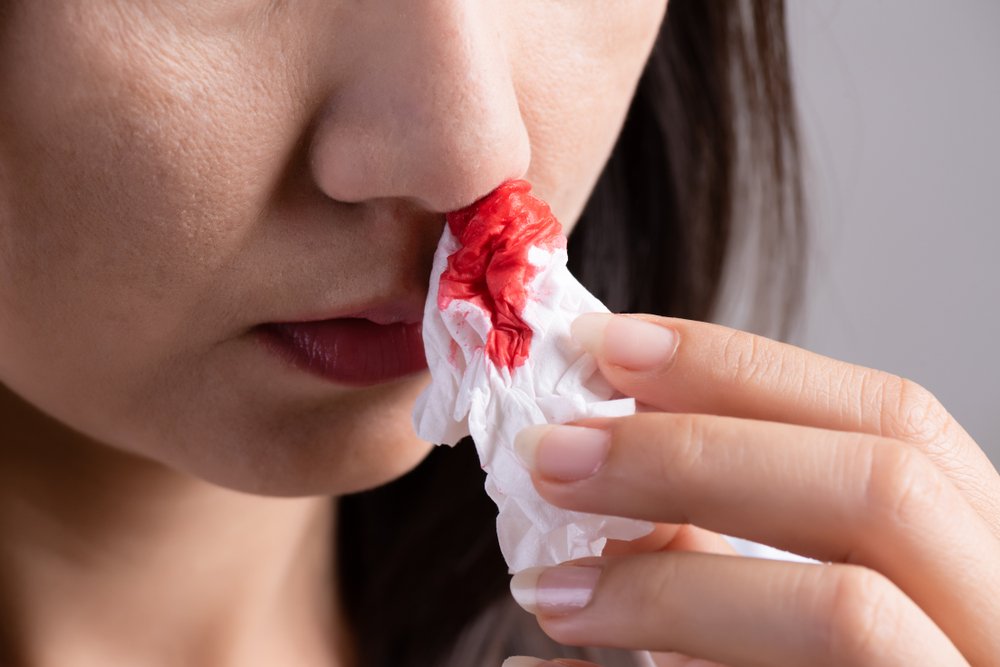 Почему возникают носовые кровотечения?