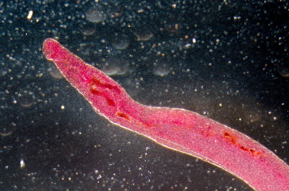 Шистосомы — гельминты с острыми шипами