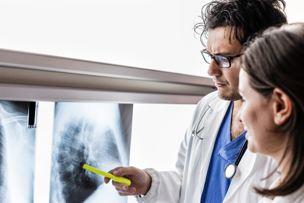 Бронхолегочный аспергиллез и астма: есть ли связь?