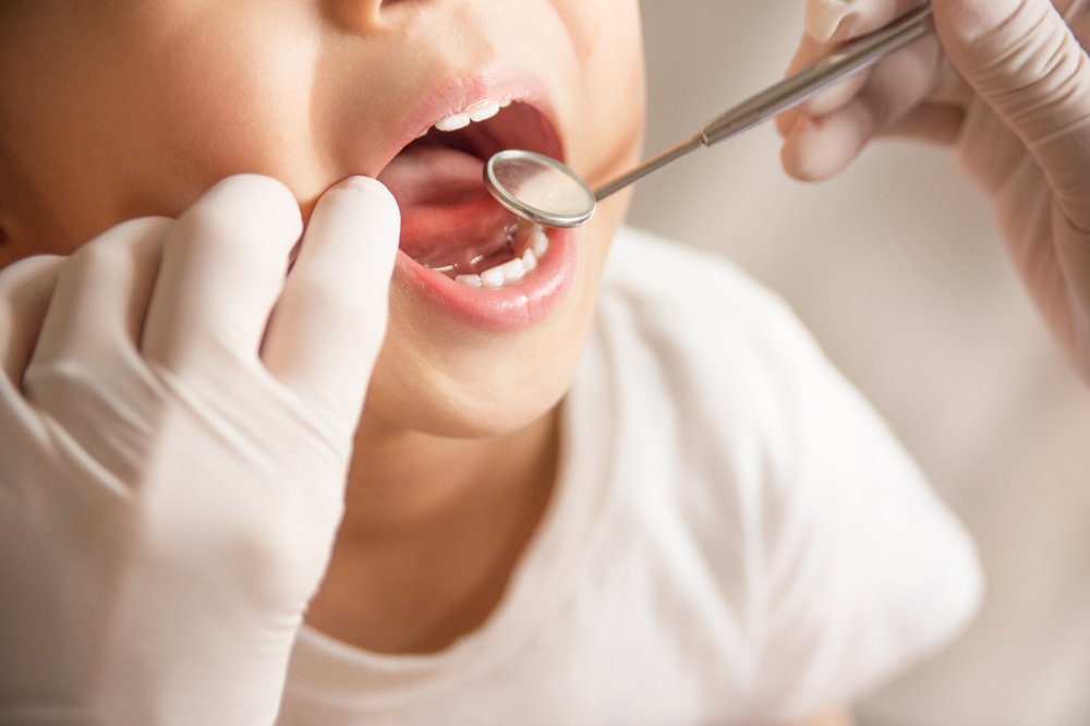 Особенности и последствия кариеса молочных зубов