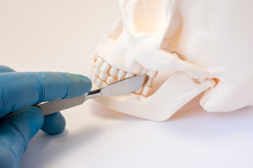 Основные причины потери зубов у людей