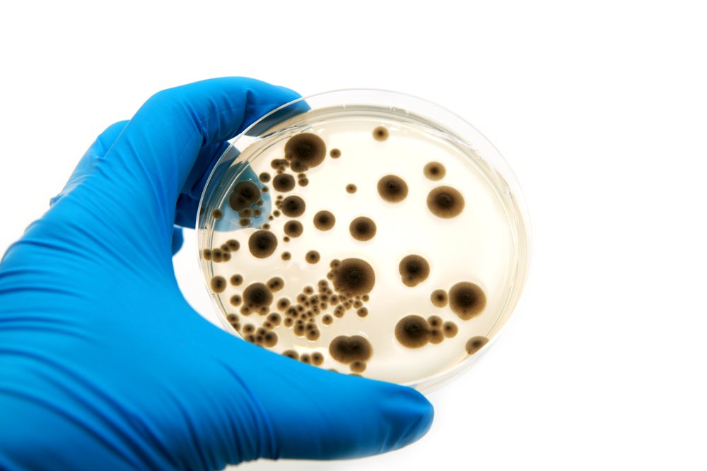 Боязнь бактерий и паразитов