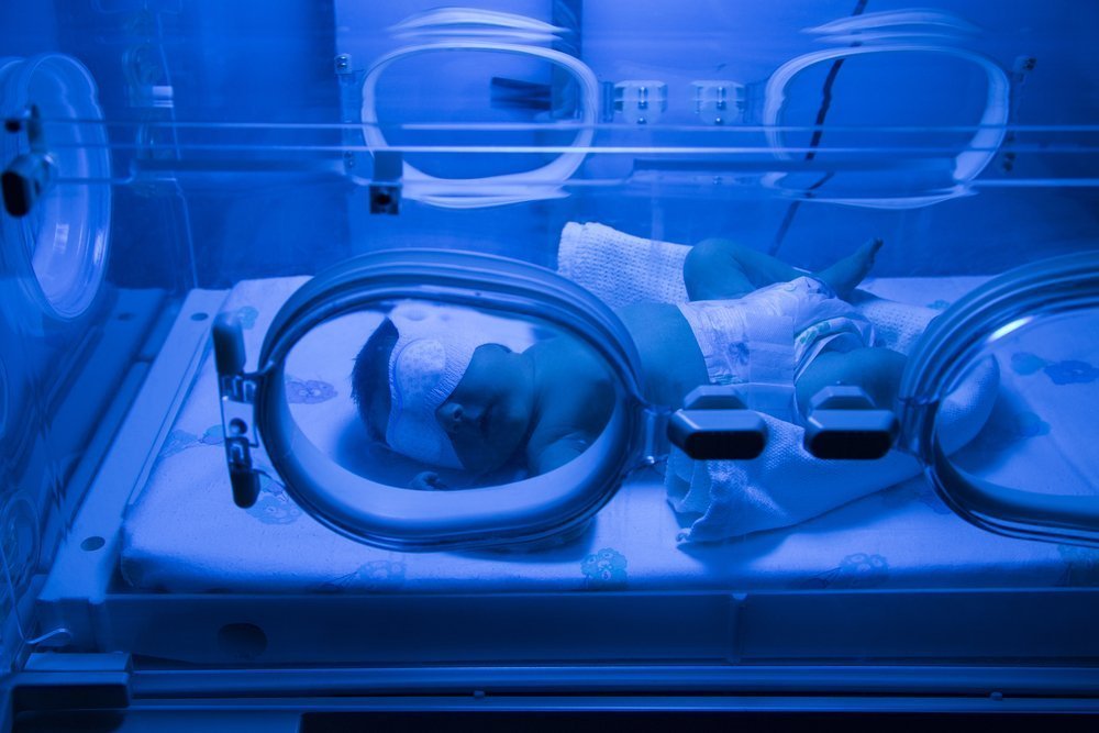 Фототерапия ─ основной метод лечения желтухи у новорожденных