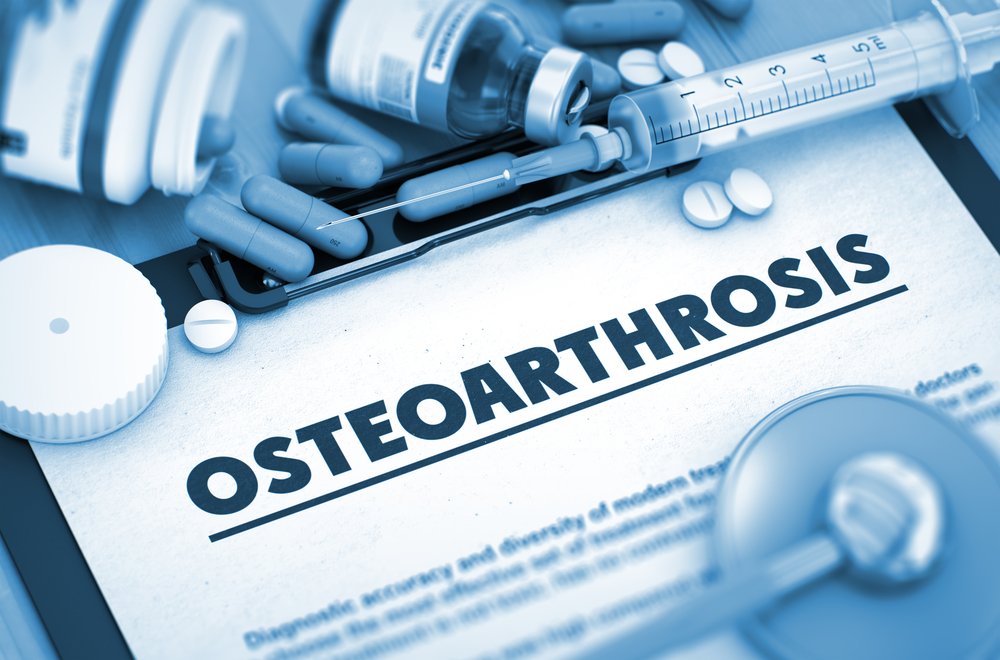 Методы лечения при деформирующем остеоартрозе
