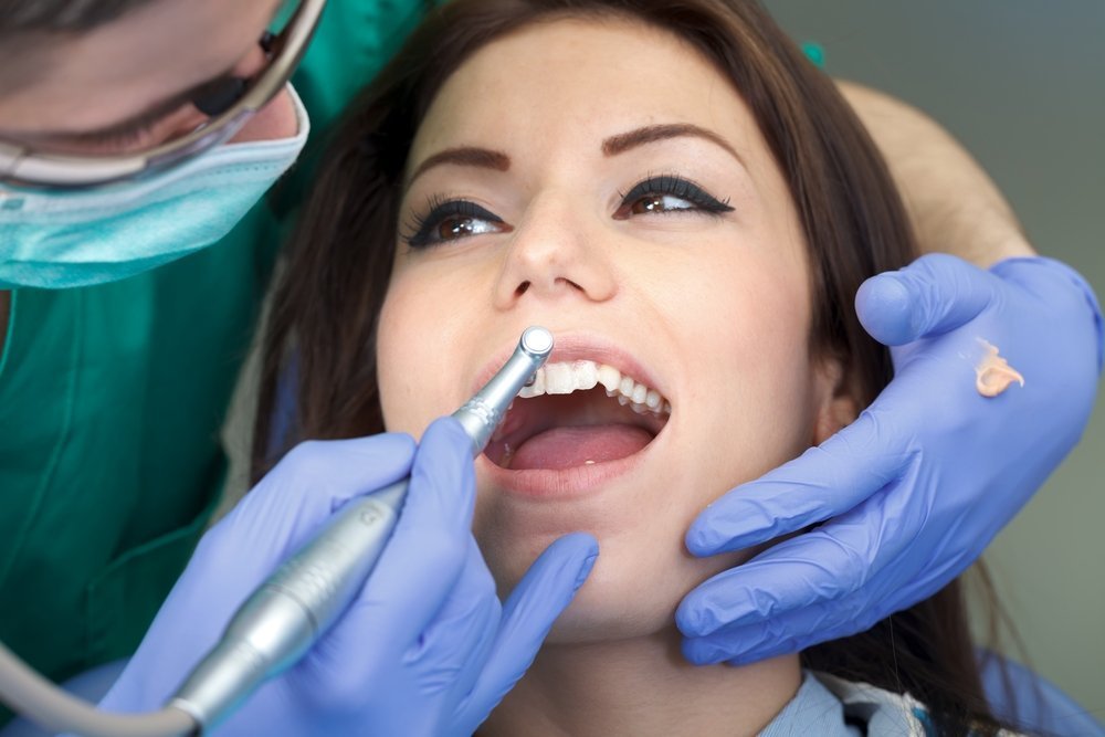 Профессиональное отбеливание в кабинете стоматолога