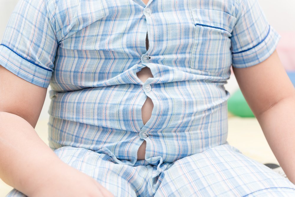 Виды ожирения у детей и взрослых
