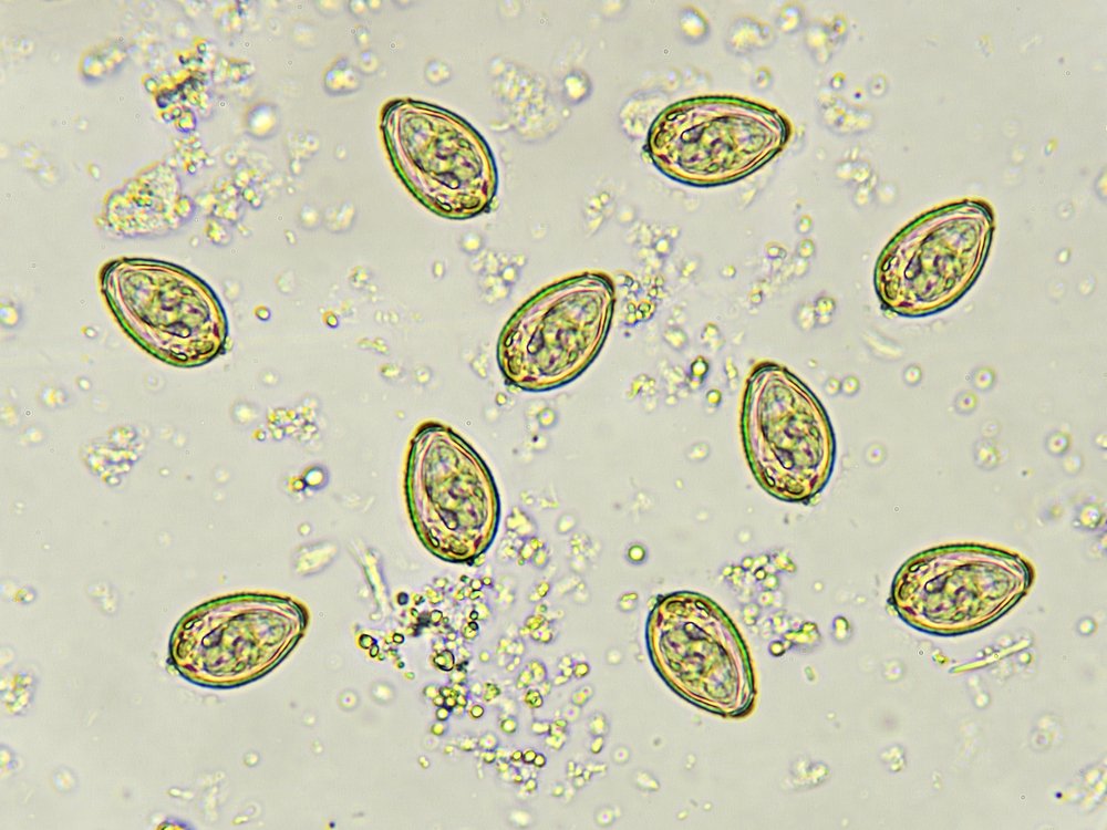 Яйца власоглава под микроскопом фото