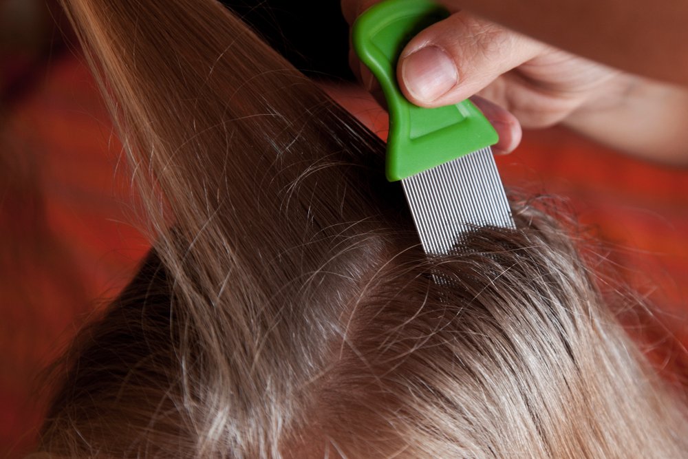 Как вычесать перхоть из волос