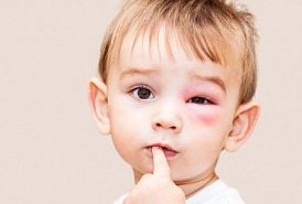 Красные флажки: 7 основных поводов для вызова скорой ребенку
