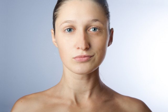 Asimmetria del volto, ruolo delle malformazioni, malattie