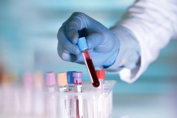 В общем анализе крови повышены соэ лейкоциты гемоглобин thumbnail