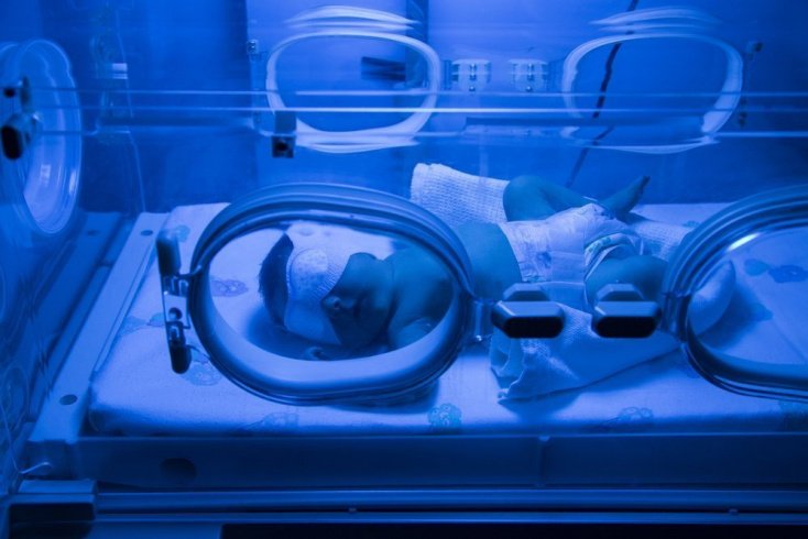 Печеночные желтухи новорожденных Печеночные желтухи новорожденных