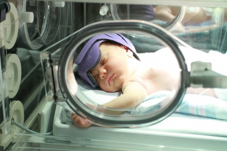 Конъюгационные желтухи у новорожденных Конъюгационные желтухи у новорожденных