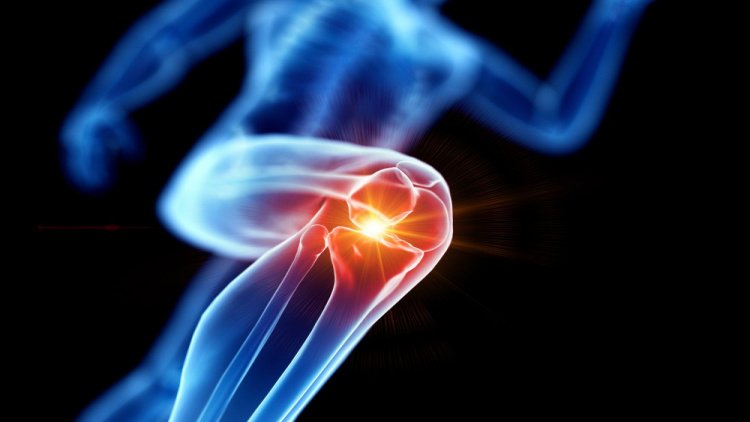 Как лечится артроз коленного сустава?