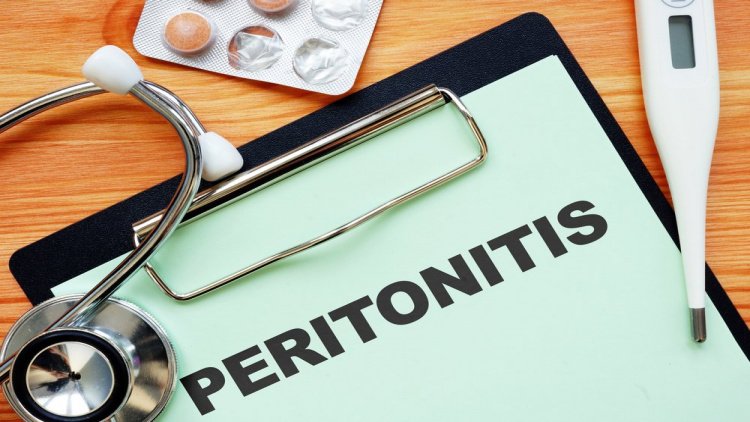 Каковы симптомы перитонита