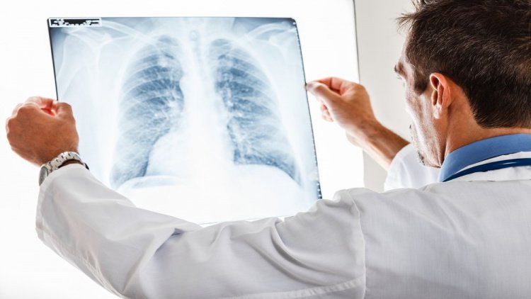 Классификация туберкулеза