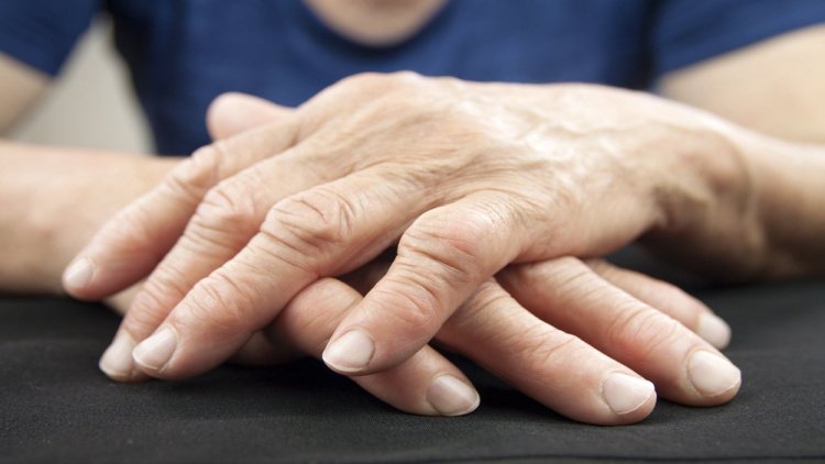 Препараты лечения артрита пальцев рук