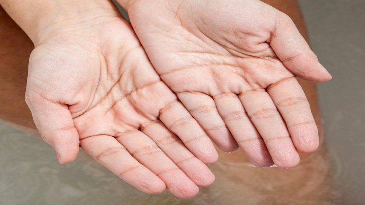 Причины сморщивания кожи пальцев рук и ног | MedAboutMe
