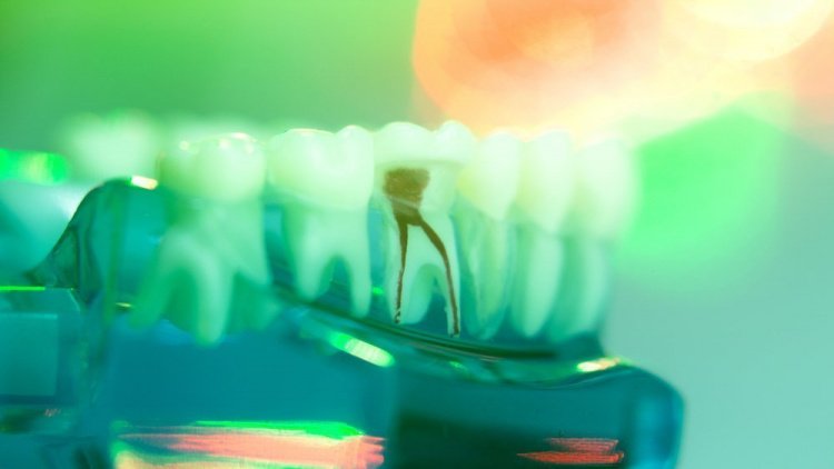 Какие ошибки может совершить стоматолог?
