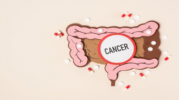 Как проявляется рак толстого кишечника?