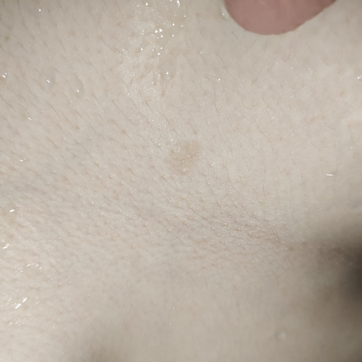 белые пятна на груди у женщин фото 89