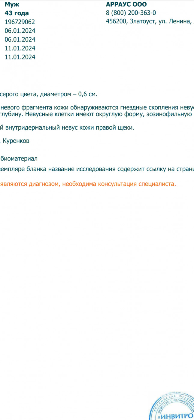 Расшифруйте гистологию невуса Внутредермальный мелоцитарный невус, невусные  | MedAboutMe